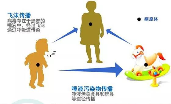 流腮.jpg